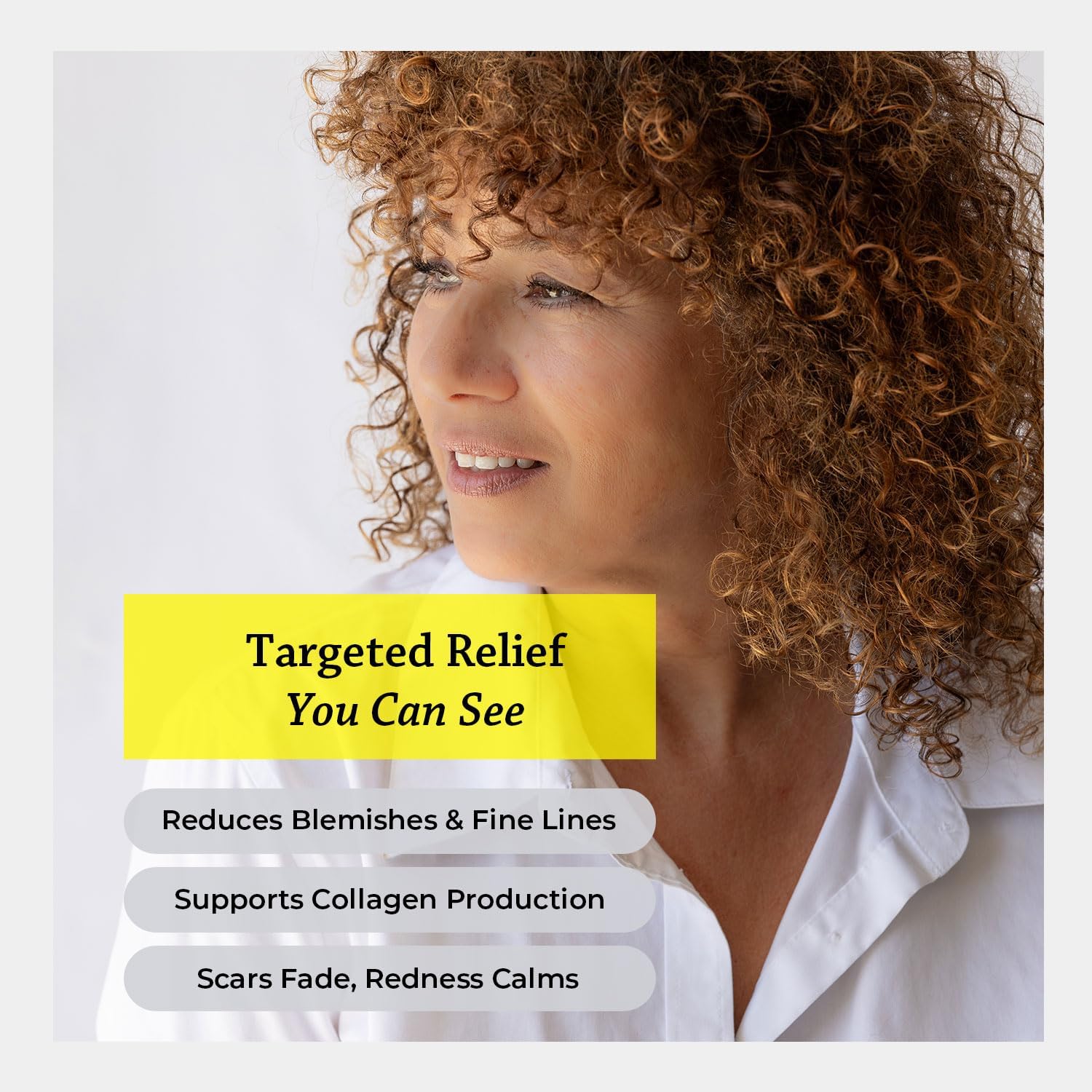 Silk Road Organic Helichrysum Italicum Essential Oil Roll on for Skin Care, Wrinkles, Scars, Bruises - USDA Certified Immortelle Oil 10ml Aromatherapy Roller - Always Pure, Always Organic - Image 2