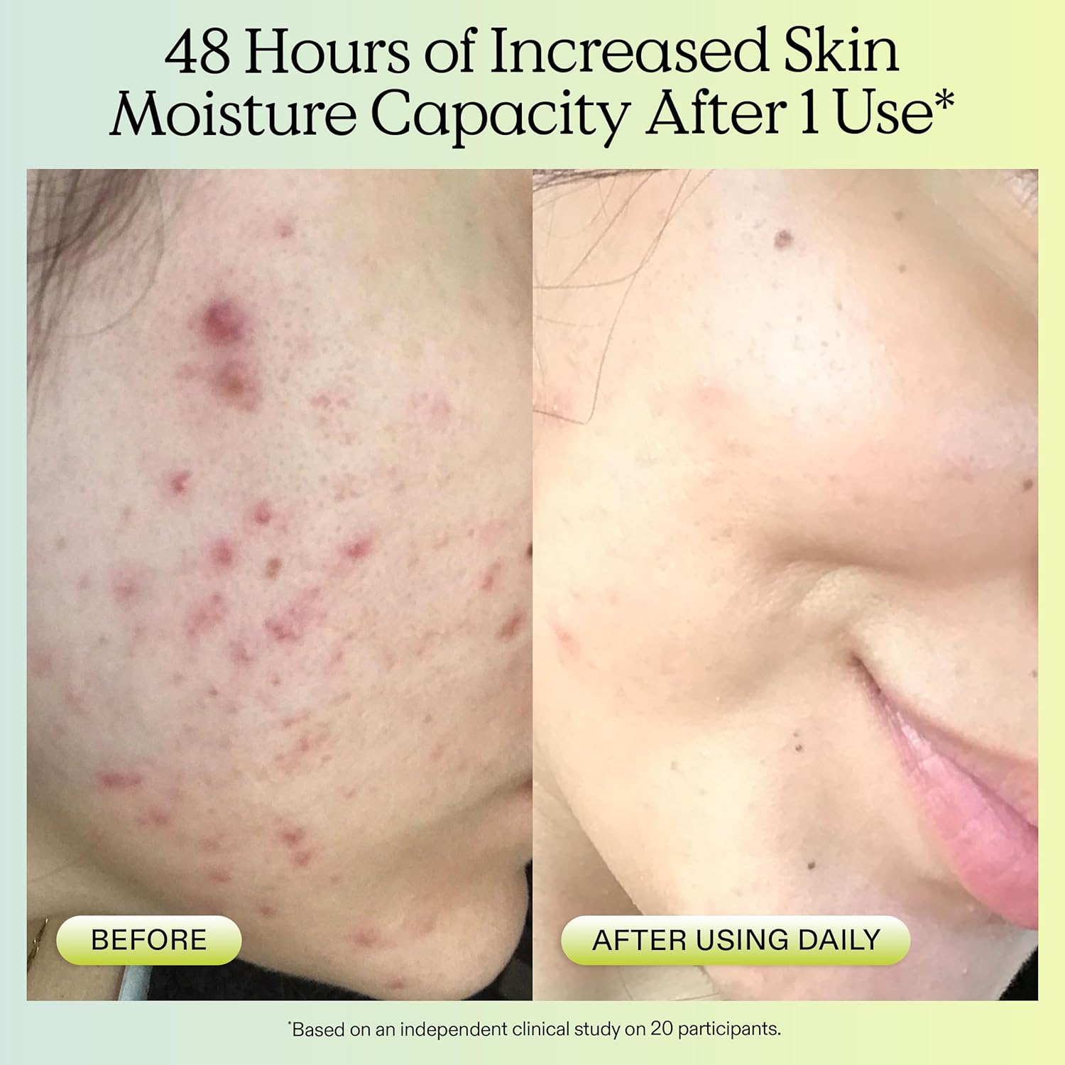 KraveBeauty Matcha Hemp Hydrating Cleanser for Dry or Sensitive Skin, Gentle, Non-Stripping Face Wash with Matcha, Hemp Seed Oil & Glycerin, Fragrance Free, 120ml - Image 3